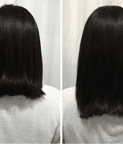 <b><i><b><i>Grow Hair</i></b></i></b> Funciona mesmo antes e depois